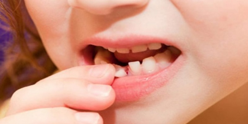 Mộng thấy rụng răng nên đánh số nào trúng thưởng khủng?